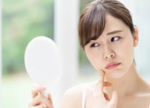 にきび（ニキビ）